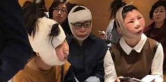 Δεν μπήκαν στο αεροπλάνο λόγω… πλαστικών επεμβάσεων!