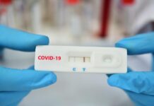 Νέα μέτρα: Σύσταση σε όσους εισέρχονται να επαναλαμβάνουν το PCR την 2η και 4η ημέρα